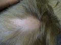 HAIR DISEASES - Alopecia Areata