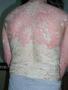 PSORIASIS - Plaque psoriasis