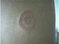 SUPERFICIAL FUNGAL INFECTIONS - Tinea corporis due to trichophyton