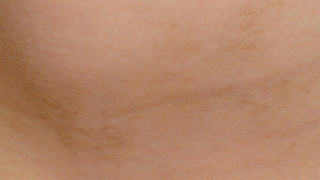 VARIOUS or of UNKNOWN ETIOLOGY DISEASES - Terra Firma VARIOUS or of UNKNOWN ETIOLOGY DISEASES - Terra Firma